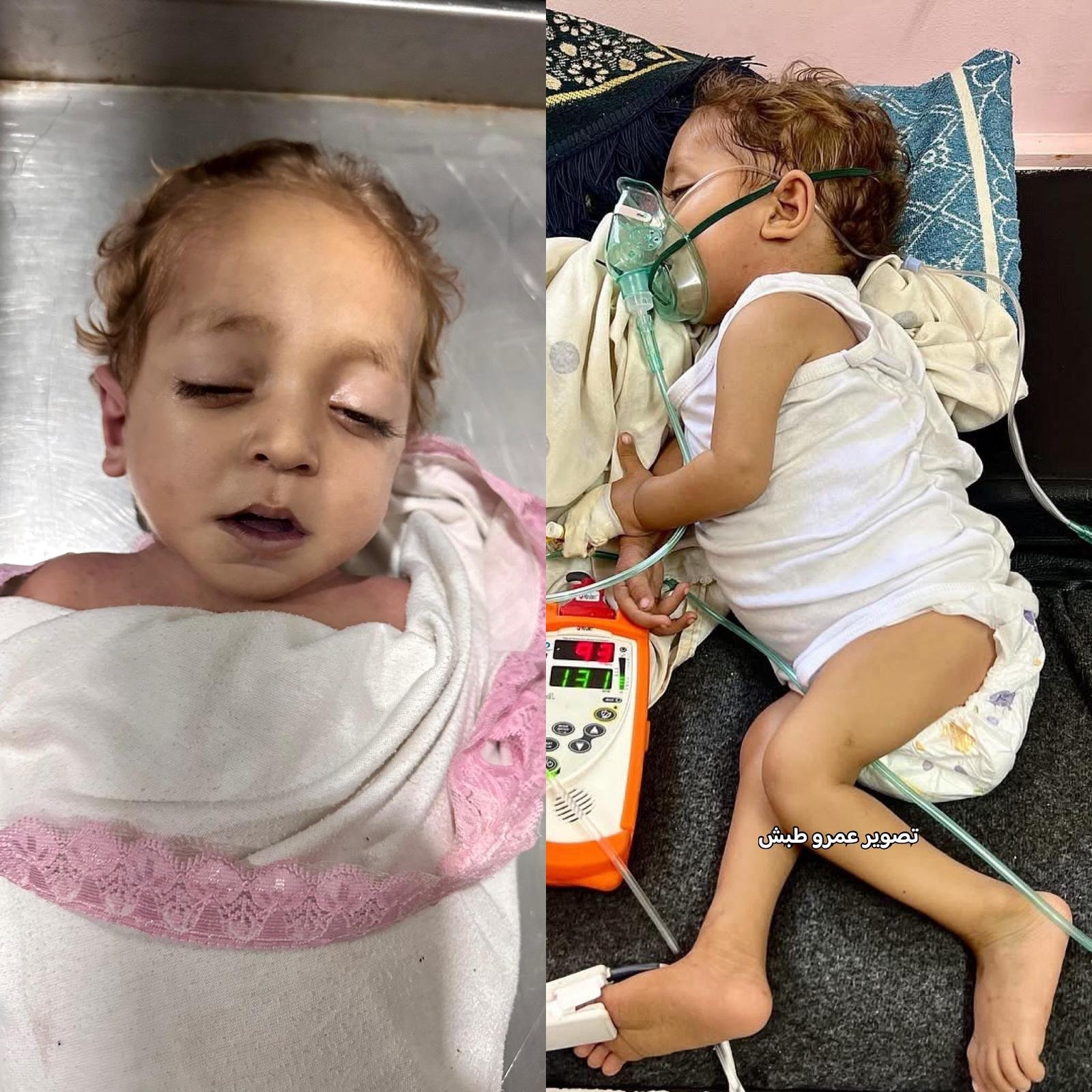 وفاة الطفل حسن بربخ من قطاع غزة نتيجة حرمانه من العلاج