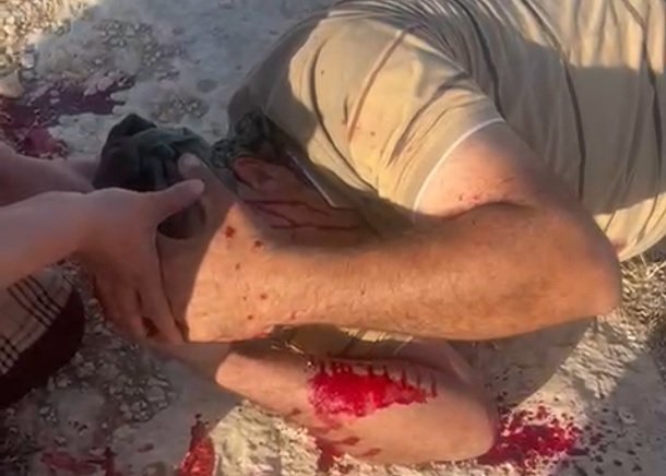 إصابة مواطن في هجوم للمستوطنين  جنوب الخليل