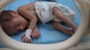 مدير الاغاثة الطبية:  نسبة تشوه الأجنة في غزة تجاوزت الـ 25% 