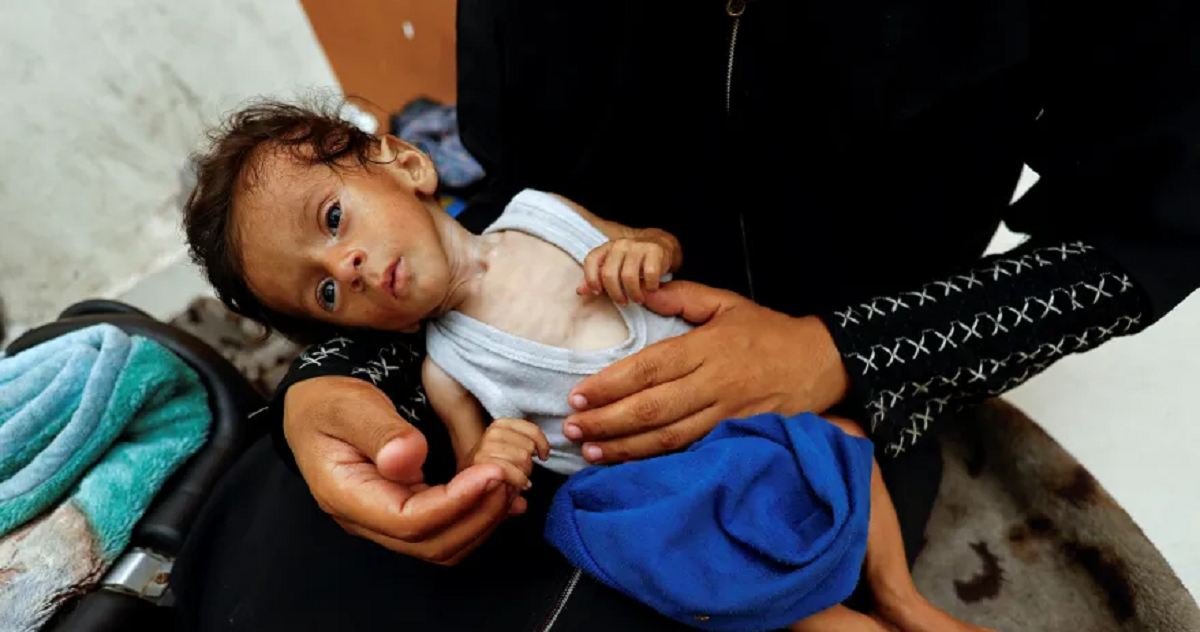 ارتفاع حصيلة ضحايا التجويع إلى 266 شهيدا بقطاع غزة