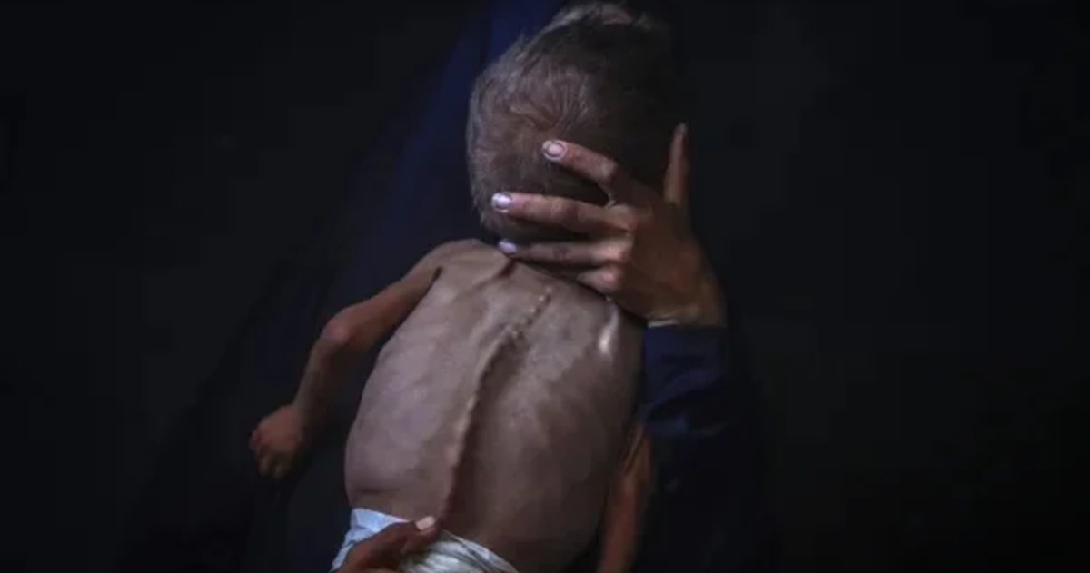 منظمات دولية : عقوبات أوروبية على اسرائيل هي التي تنقذ غزة وليس غيرها  