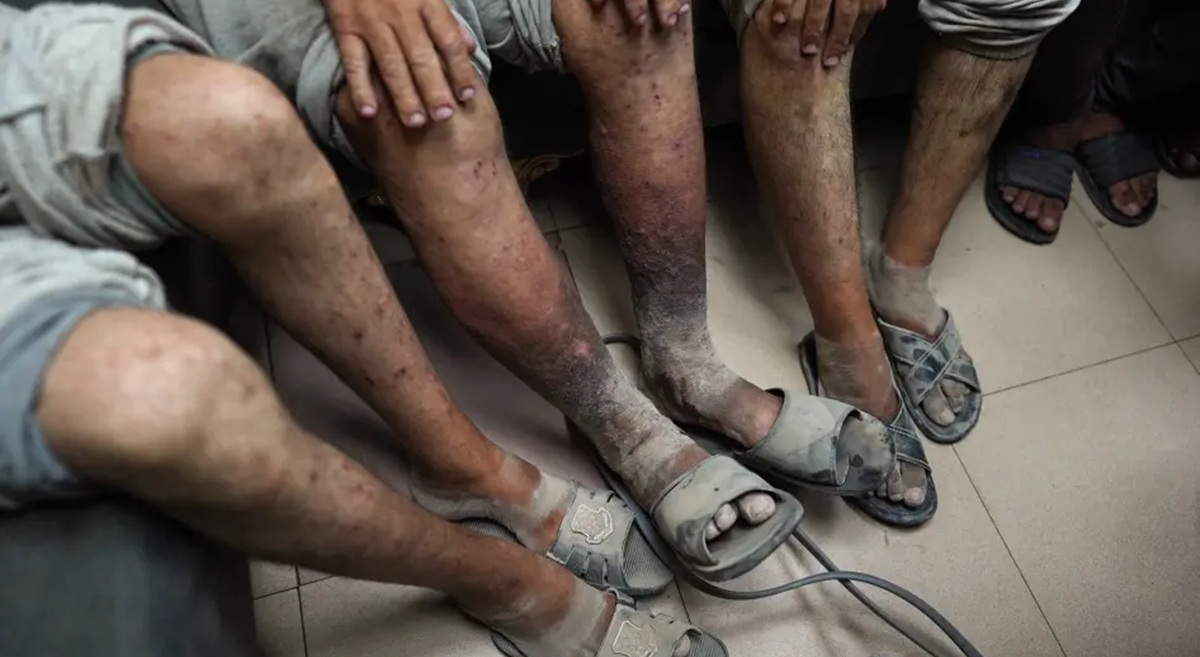 ورقة لمركز "شمس" : حين يتحول الجسد الفلسطيني إلى مختبر: إسرائيل كمنتج ومُصّدر لأدوات التعذيب