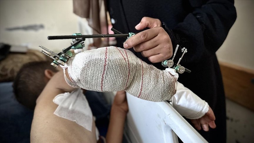 الأورومتوسطي: 30 مواطنا  يصابون بإعاقات دائمة أو مؤقتة يوميا بغزة