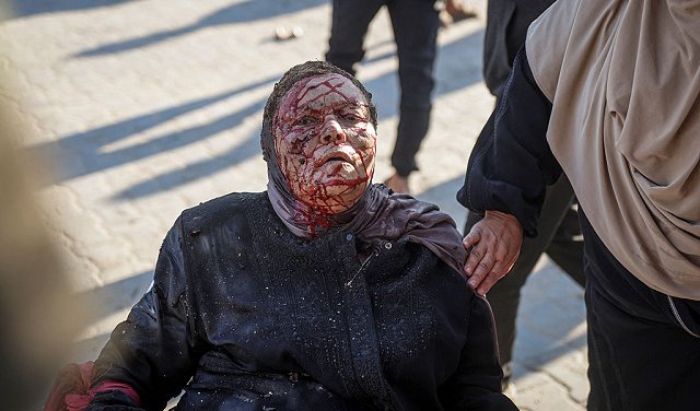 ليلى مرتجى... قصدت البحر للراحة فشوّهت إسرائيل وجهها وقطعت يدها