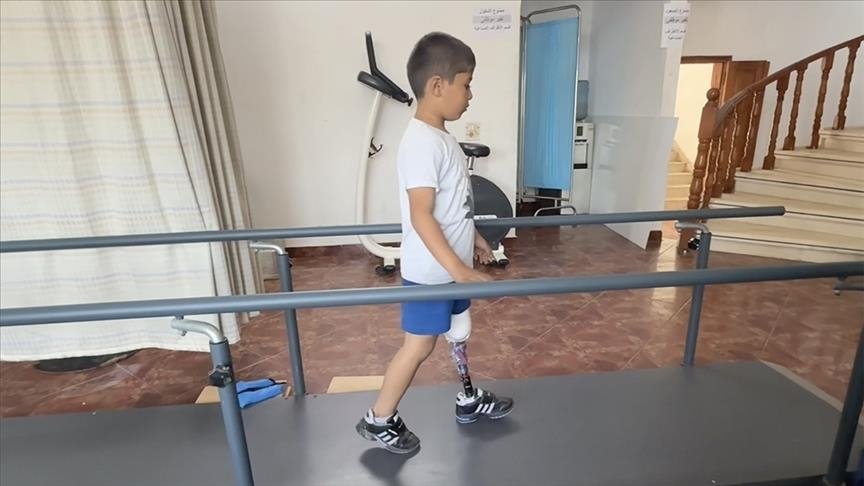 جمعية تركية تركب أطرافا صناعية لمصابين من غزة