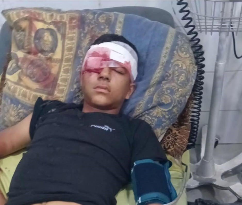 إصابة طفل بجروح خطيرة خلال اقتحام الاحتلال بيت عوا